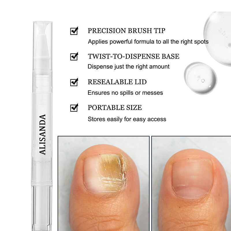 Toenail Fungus Treatment Pen for Damaged Nails