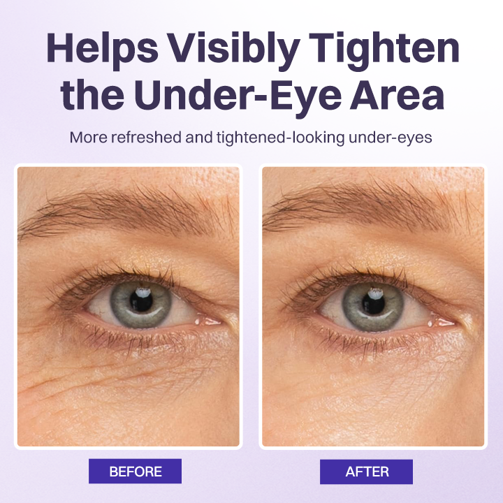 LOVILDS® Instant Lift Eye Gel