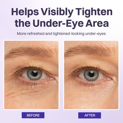 LOVILDS® Instant Lift Eye Gel