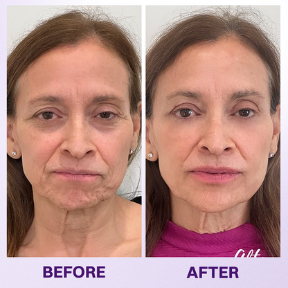 LOVILDS® Instant Lift Eye Gel