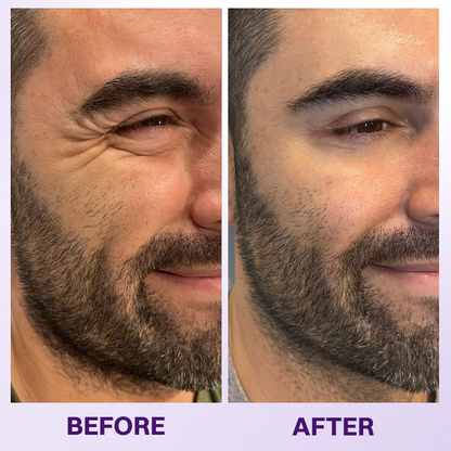 LOVILDS® Instant Lift Eye Gel