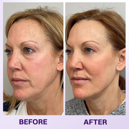LOVILDS® Instant Lift Eye Gel