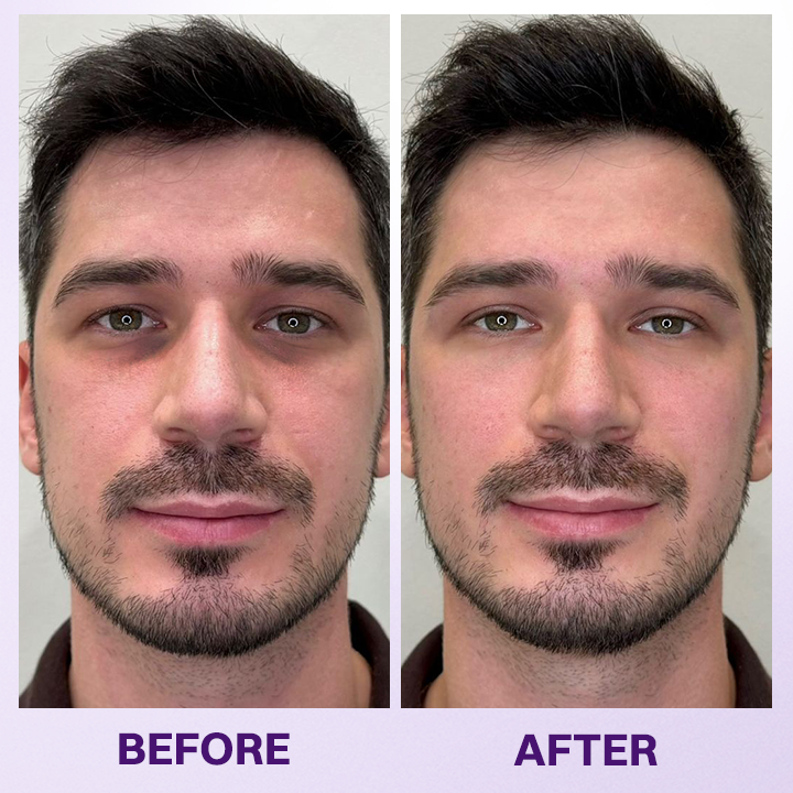 LOVILDS® Instant Lift Eye Gel