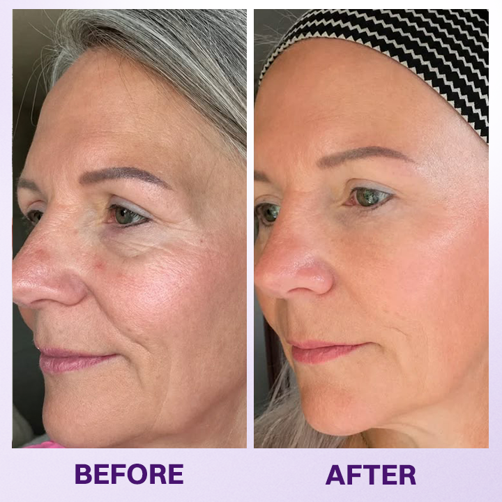 LOVILDS® Instant Lift Eye Gel